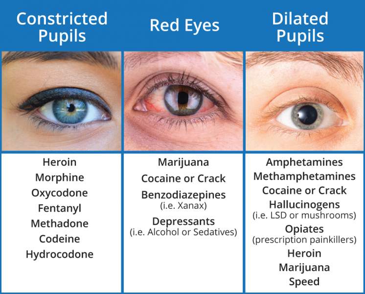 what do blown pupils look like